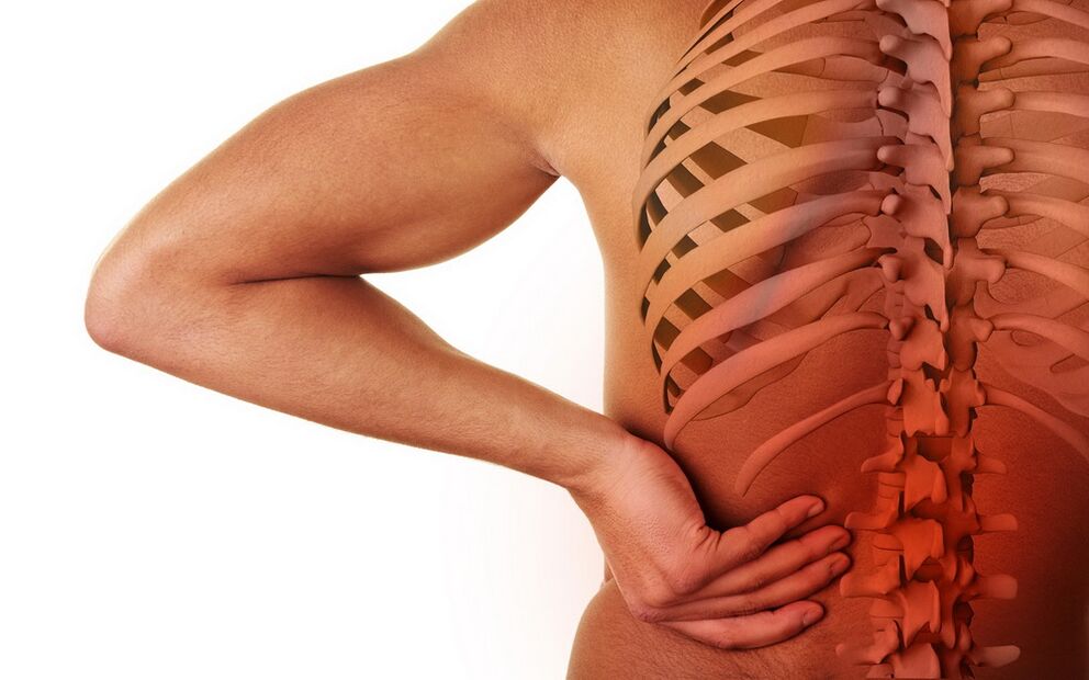 back pain due to osteoarthritis