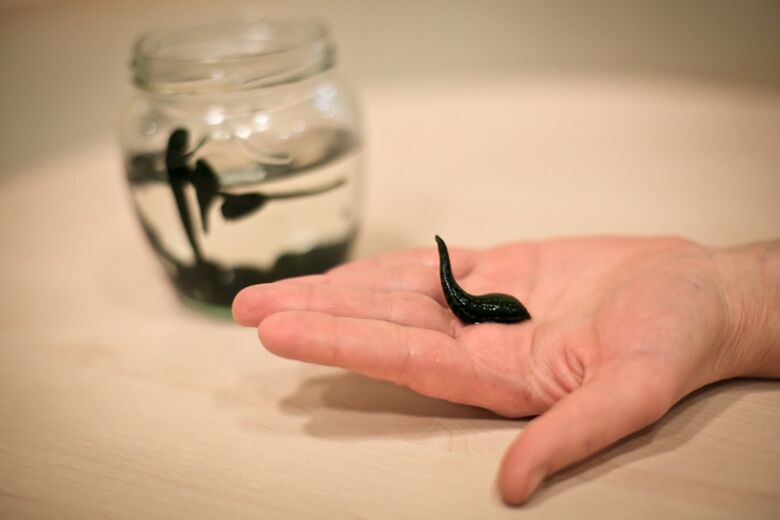 leeches to treat arthritis