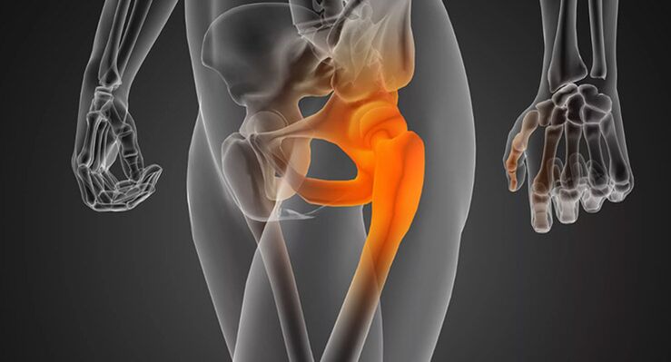 Infected hip pain requires treatment with antibiotics