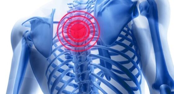 Treatment of osteoarthritis of the chest spine