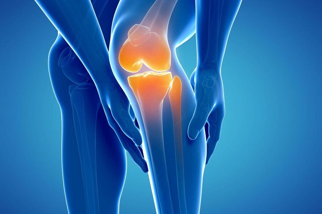 What is Arthrosis