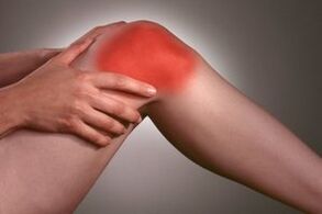 Knee pain due to arthritis